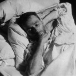 Egon Schiele with Spanish flu